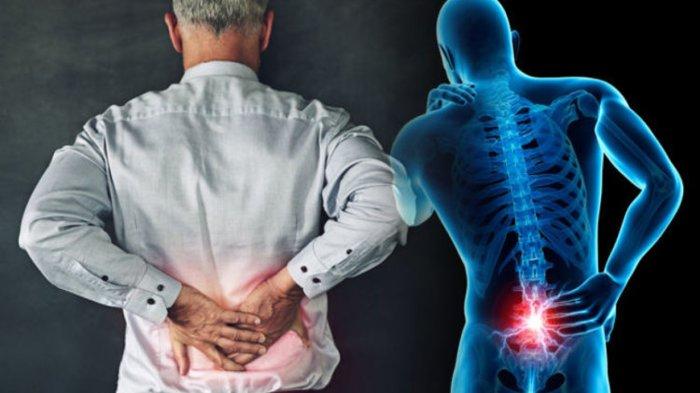 Mengenal Osteoporosis: Penyebab, Gejala, dan Cara Mengatasinya